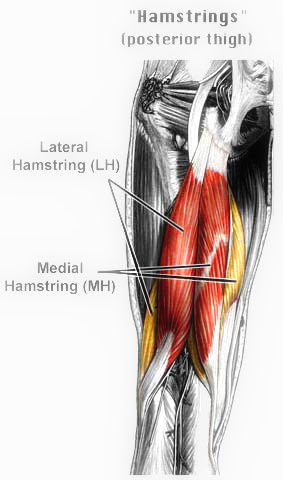 it is a tear in one or more of the hamstring muscles. 