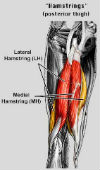 A hamstring strain or a pulled hamstring